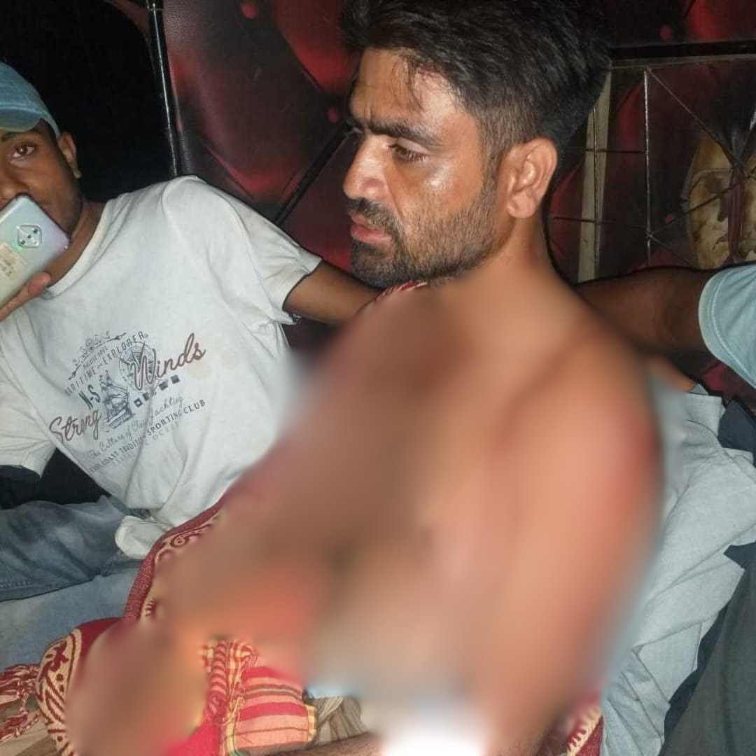 সুনামগঞ্জের সীমান্তে বিএসএফ’র গুলিতে বাংলাদেশি যুবক আহত