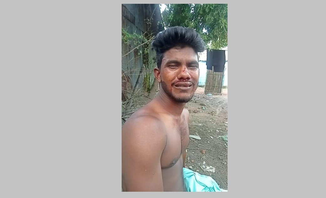 মুন্সিগঞ্জে যুবককে হাতুড়ি পেটা করে আওয়ামী লীগ নেতা