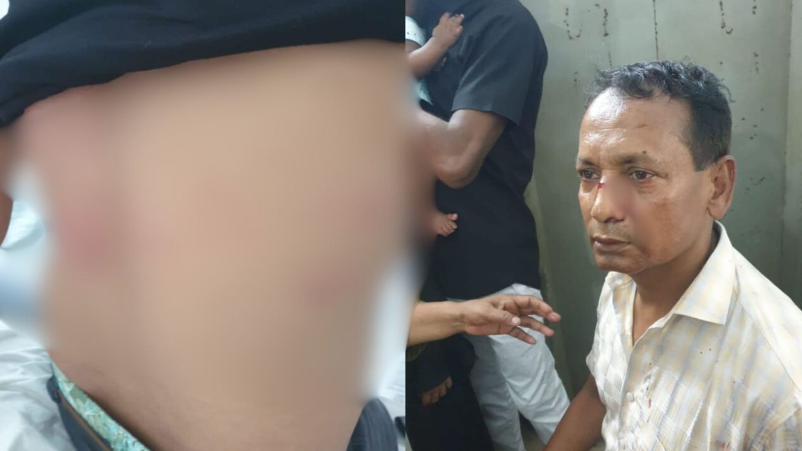 সিরাজদিখানে মাদরাসার আয় ব্যয়ের হিসাব চাওয়াকে কেন্দ্র করে প্রতিপক্ষের হামলায় আহত-৪